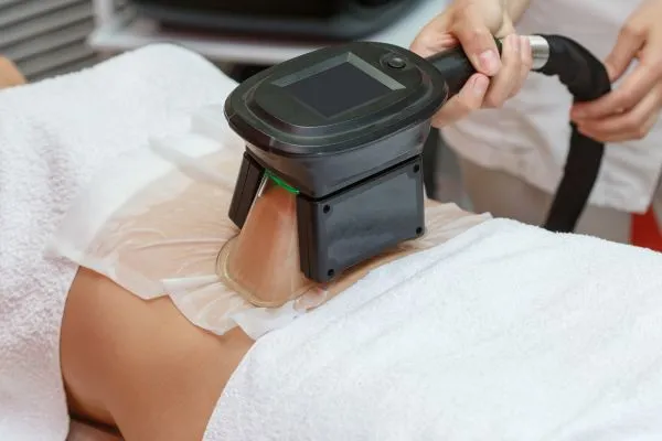 Image of person having fat freezing treatment to help weight gain Wigan