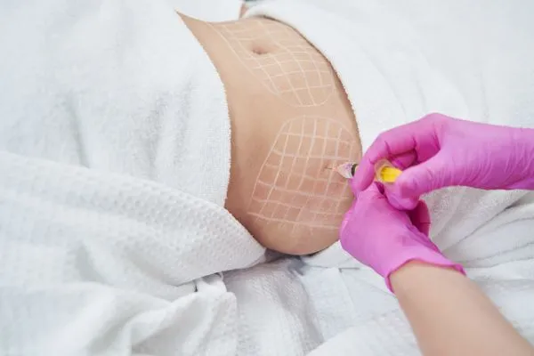image of fat dissolving injections on love handles to help combat weight gain Wigan