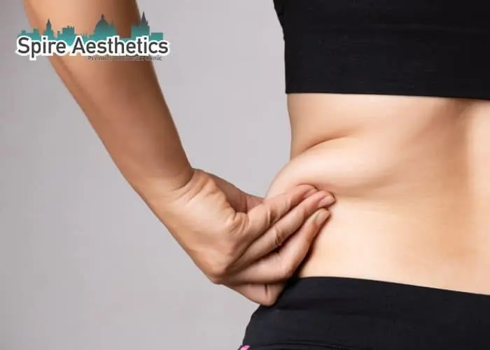Image of woman pinching fat on their hips Wigan. Fat Freezing treatment
