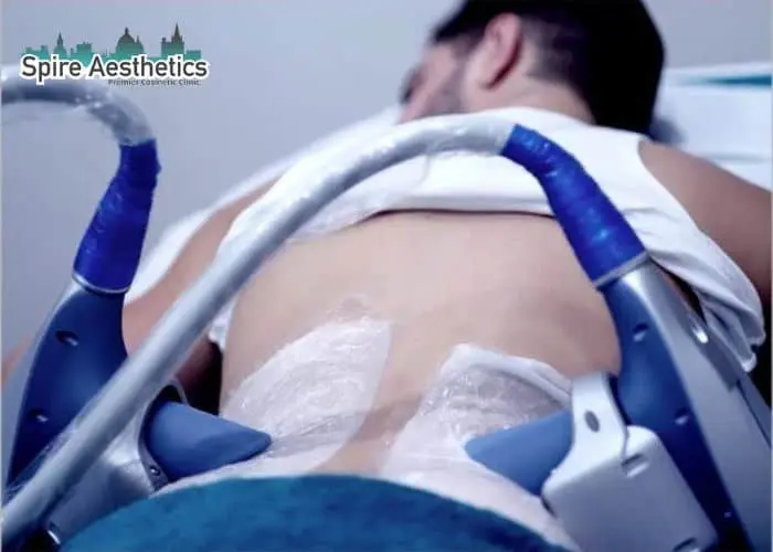 Man having fat freezing treatment done on love handles before a competitions Wigan to create a sculpted look.