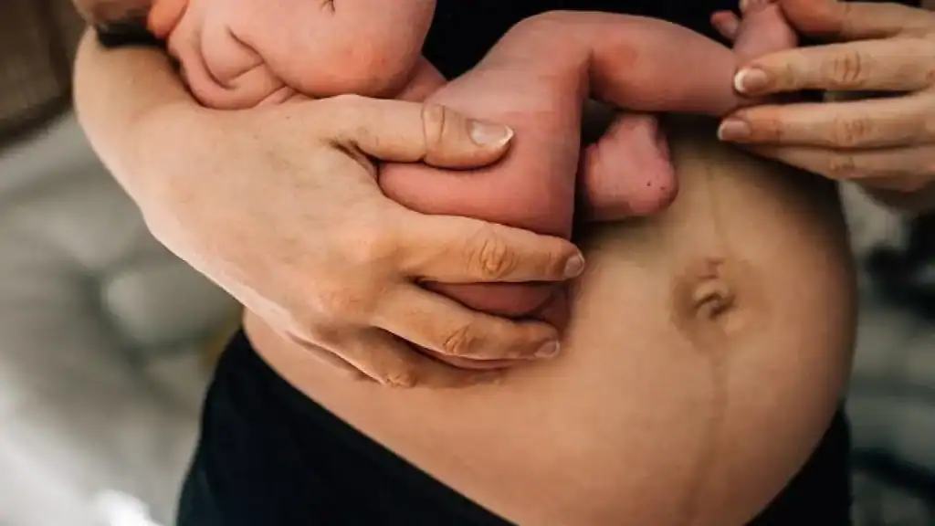 Why Is My Stomach Still Big After Pregnancy Wigan?